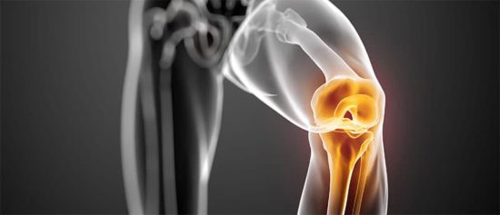 arthrose du genou illustration