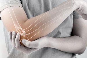 L’arthrose en quelques chiffres