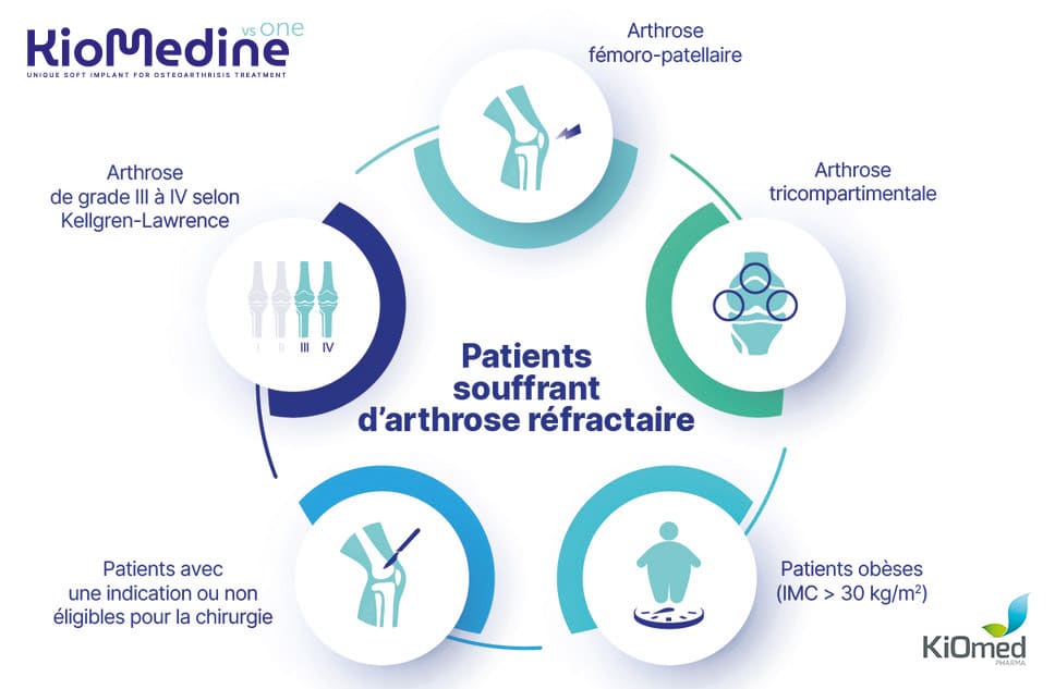 Patients souffrant d'arthrose réfractaire - kiomed Pharma